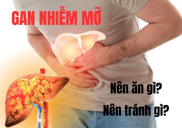 bị gan nhiễm mỡ nên ăn gì