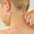 bị thủy đậu nên tắm lá gì (1)