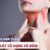 Hướng dẫn cách trị đau rát cổ họng có đờm nhanh khỏi